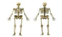 Therapy for Rare Bone Disorder Shows Promise in NIH Clinical Trial
